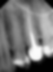 OPTEO-Radio-Intraoral-01-c.png