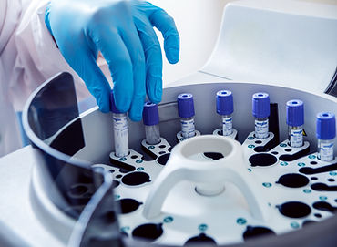 Operación de centrífuga de laboratorio