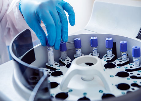 Medizinische Laboranalyse – Probenröhrchen in einem Labor, symbolisiert umfassende Blutanalyse und tiefgehende Gesundheitsdiagnostik.