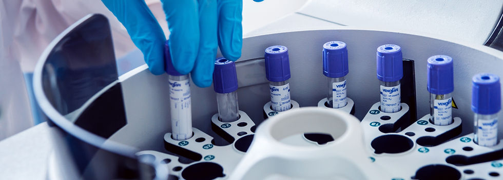 Blue gloves handling vials