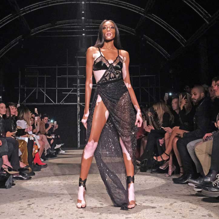 Winnie Harlow Amazing