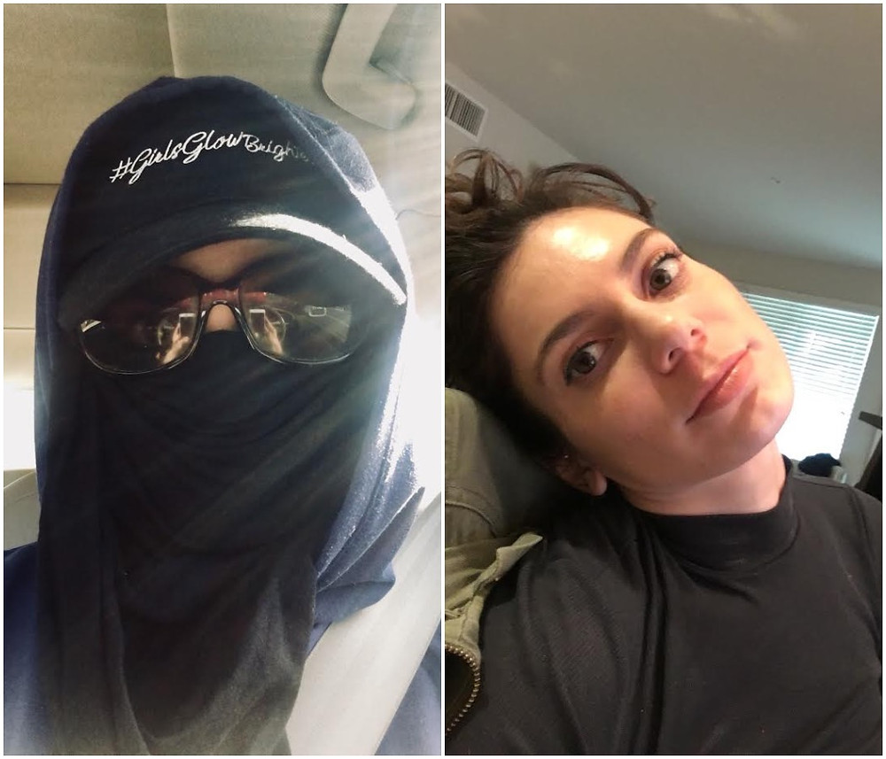 post treatment skincare