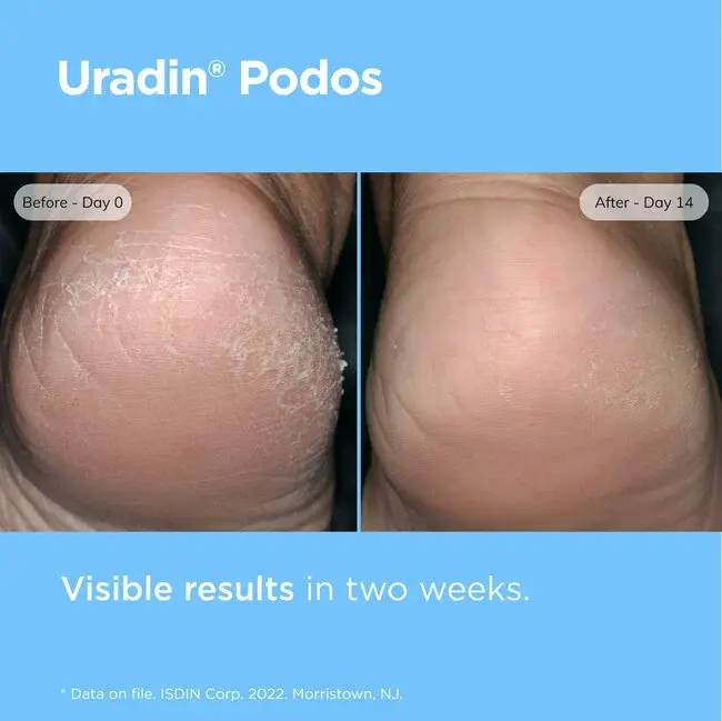 Thumbnail: Uradin Podos Hydrating Gel Oil