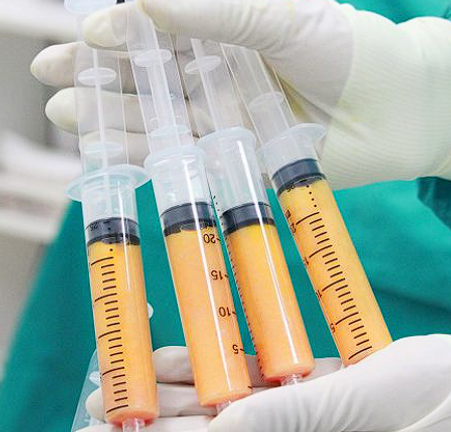 fat grafting injection