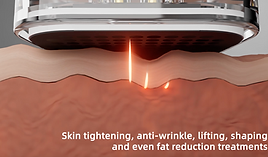 Handpiece from RF Fractional Machine