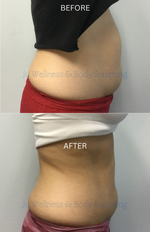 Client lost 1 3/4" in the abdomen in 4 weeks