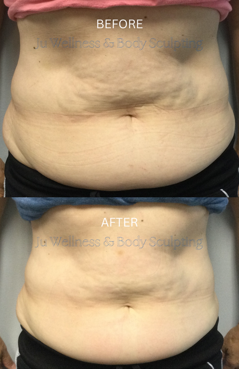 Client lost 1 1/2" in the abdomen in 3 weeks