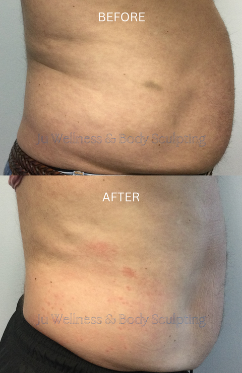 Client lost 4" in the abdomen in 12 weeks