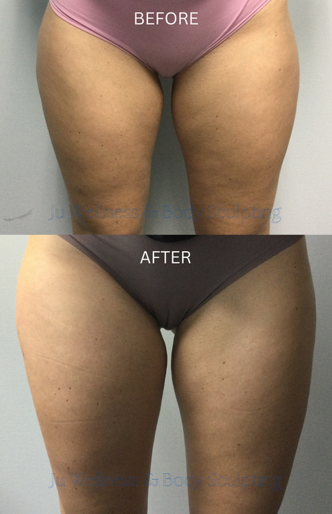 Client lost 1 1/2" in the abdomen in 11 weeks