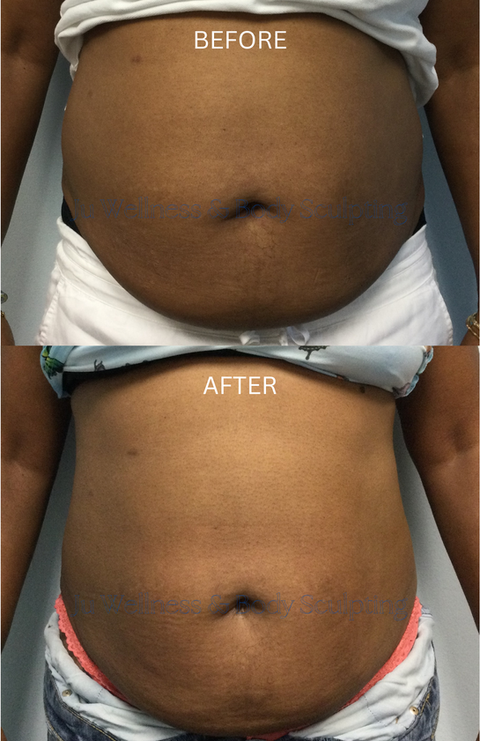 Client lost 2 3/4" in the abdomen in 10 weeks