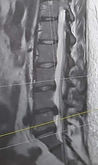 MRI scan.jpg