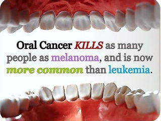 oral cancer
