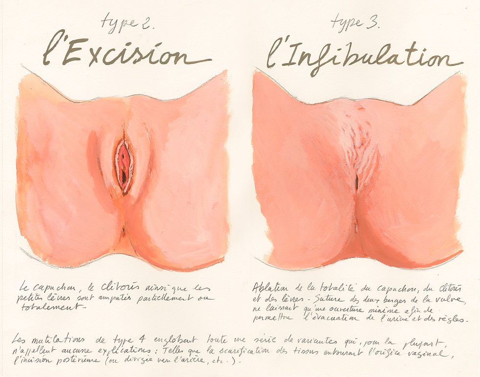 mutilation sexuelle culturelle