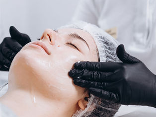 Lifting away years of sun damage … and more! FAQs about medical-grade peels