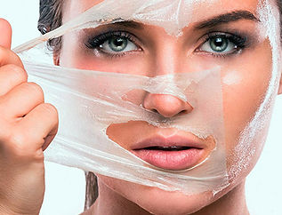 Peeling Químico