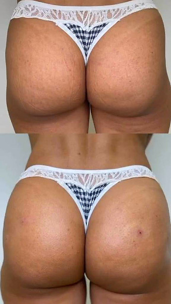 bumbum empinado