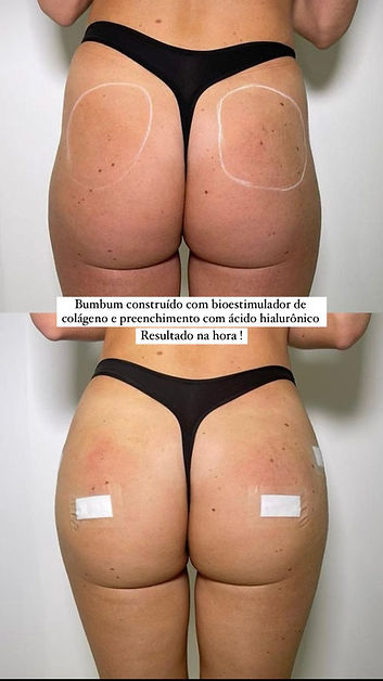 aumentar bumbum