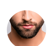 Depilação a Laser na Barba.png