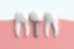 23179123_s.jpg