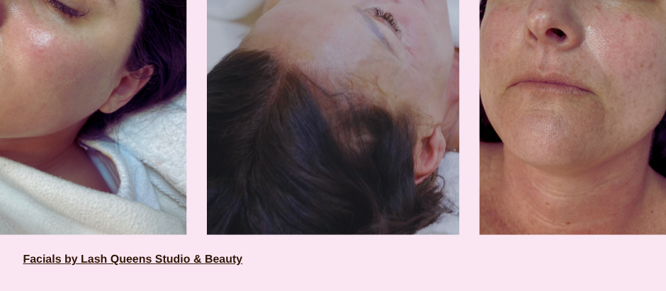 Facial treatments at Lash Queens Studio and Beauty showing glowing skin results after professional skincare