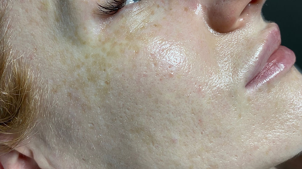Korean Facial by Lash Queens Studio and Beauty