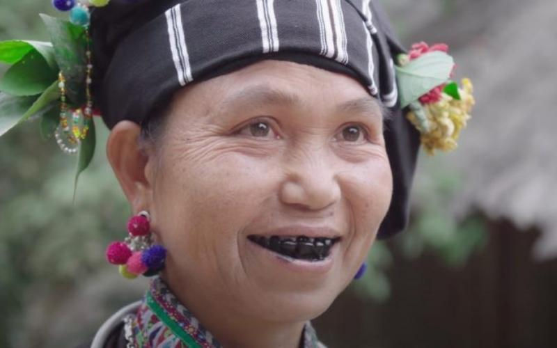 Ăn trầu răng bị đen