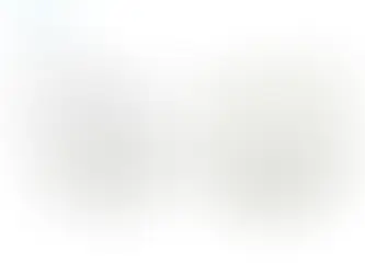 Mắc cài sứ bị vàng