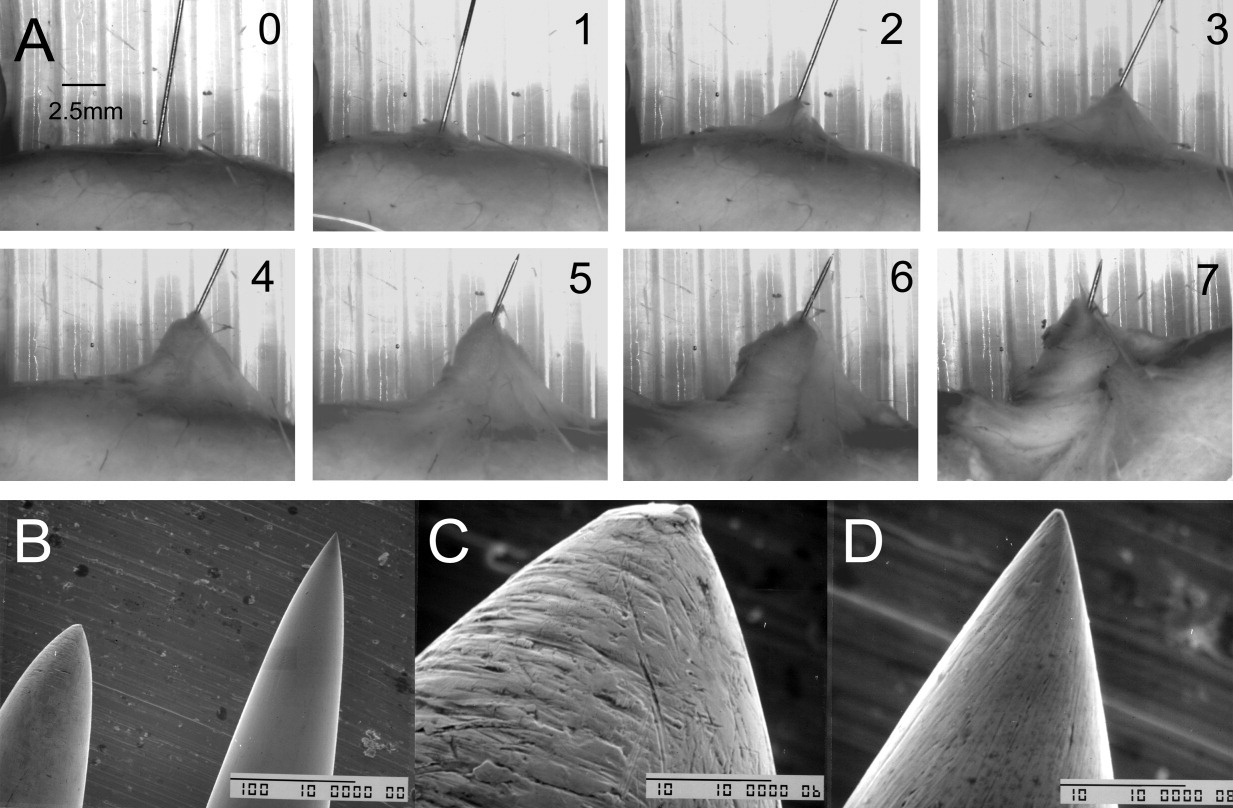 Original cover: Dry Needling Literature/ Evidence
