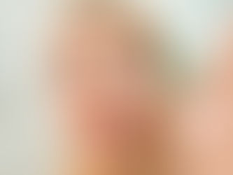 Frau mit trockener Haut