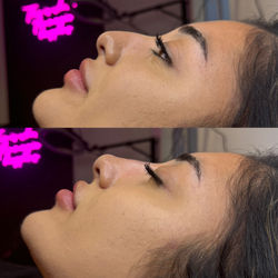 AAAB176A-5811-42F9-AD49-A2FEBABB37E5