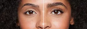 browlift.webp