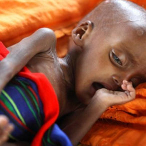 1,5 εκατ. νεκροί από την πείνα, αλλά δεν είναι μεταδοτική και έτσι δεν μας αφορά (σχόλιο για τον κορ