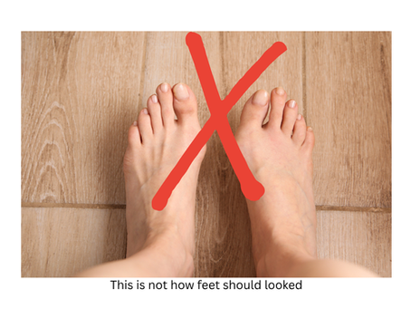 Understanding Common Foot Pain Causes and Effective Remedies Foot 