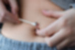 Young girl applying antibiotic cream on infected belly button piercing