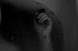 Dead body