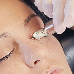 MiBo ThermoFlo®: A Gentle, In-Office Approach to Meibomian Gland Dysfunction
