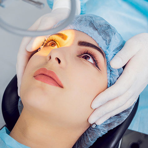LASIK Procedure