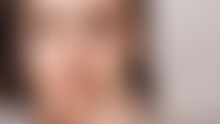 How Thermal One Touch Works to Relieve Dry Eye Symptoms
