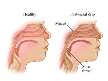 Could Mold Be Behind Your Chronic Mucus and Sinus Issues?