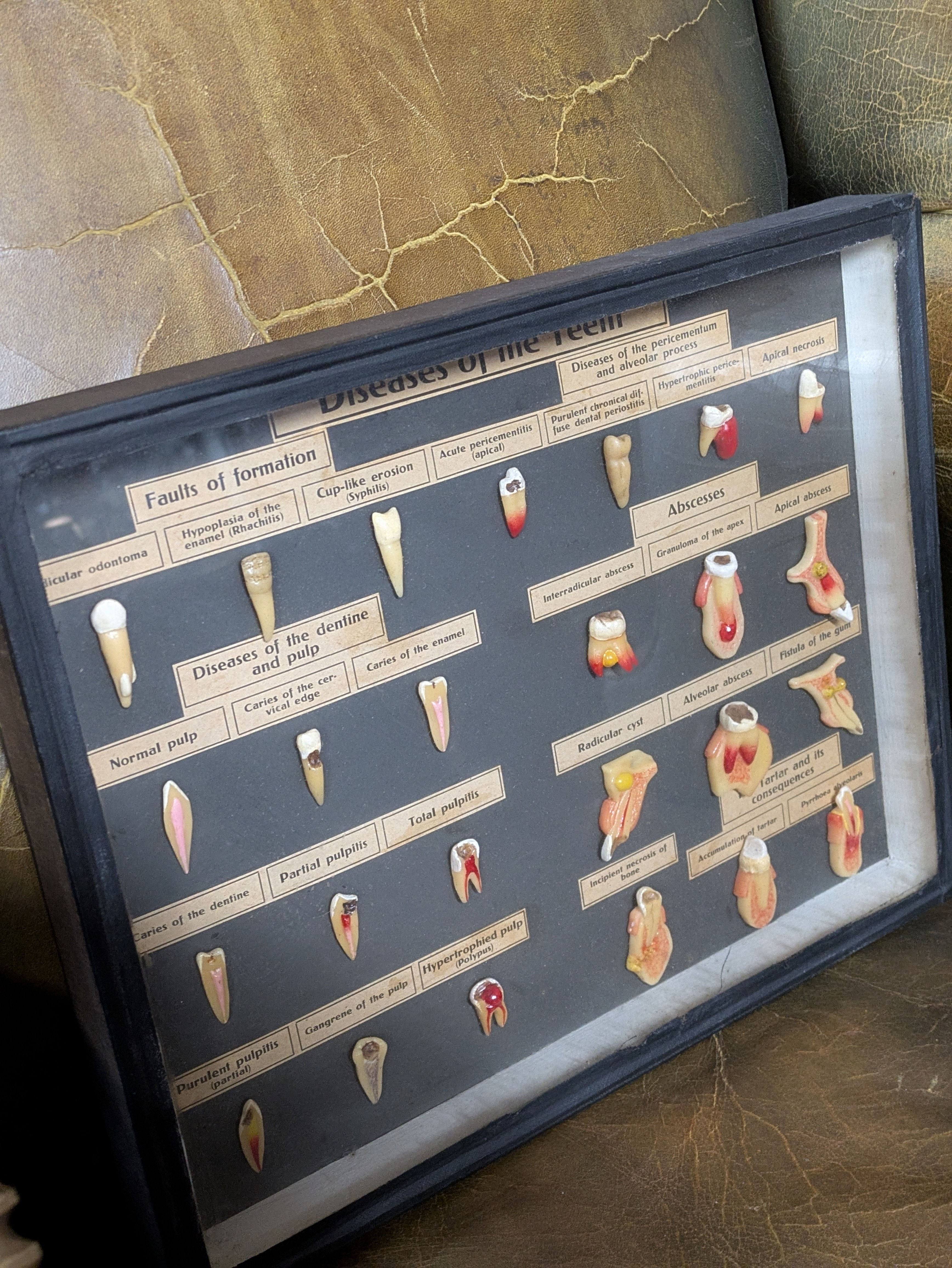 German Diseases of the teeth