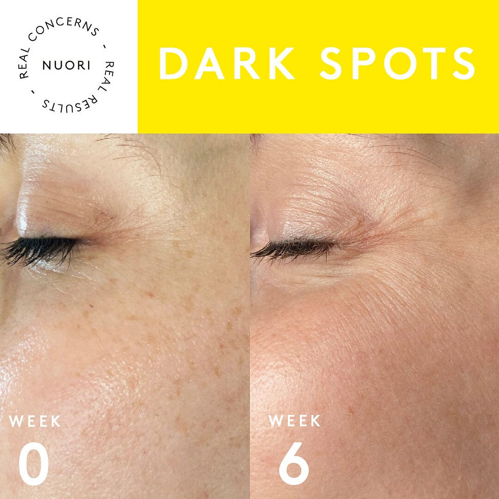 Thumbnail: Vital Facial Cream Nuori