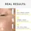 Thumbnail: Supreme-C serum Treatment Nuori