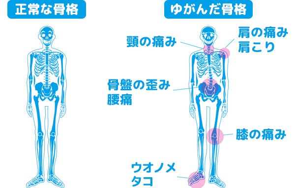 footcare-kokkaku.gif