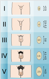子供の成長ホルモン治療１３