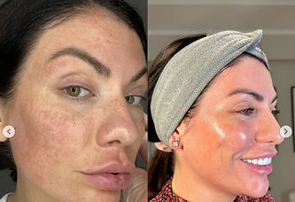 Treat sun damage and pigmentation with Danielle Mae Cosmetics in Norwich