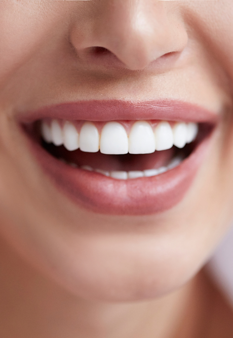 Clareamento Dental