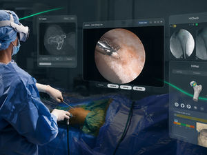 SportSuite Vision Becomes the First FDA-Authorized OR App for Apple Vision Pro