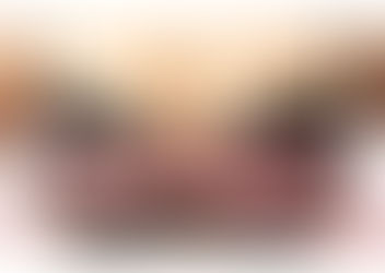 Mamoplastia: Alívio para a Coluna e Melhoria da Qualidade de Vida