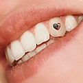 Zahnschmuck - Herz.jpeg