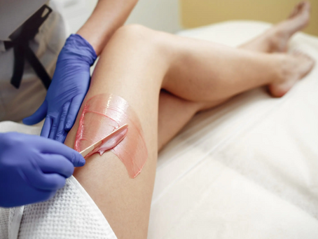 Waarom Sugaring De Beste Ontharingsmethode Is